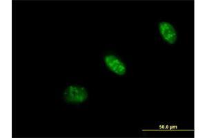 Immunofluorescence of purified MaxPab antibody to PRAF1 on HeLa cell. (POLR1E Antikörper  (AA 1-419))
