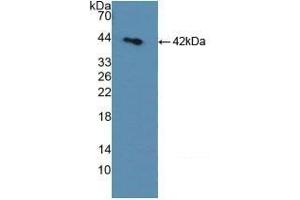 Detection of Recombinant SDH, Rat using Polyclonal Antibody to Sorbitol Dehydrogenase (SDH) (SORD Antikörper  (AA 2-357))