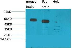 Western Blot (WB) analysis of 1) Mouse Brain Tissue, 2)Rat Brain Tissue, 3)Human Brain Tissue, with CCKBR Rabbit Polyclonal Antibody diluted at 1:2000. (CCKBR Antikörper)