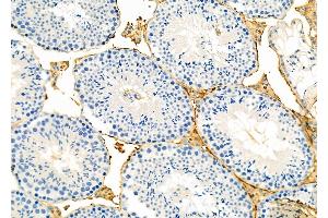 ABIN6265576 and ABIN6273176 at 1/100 staining Mouse testis tissue by IHC-P. (TIMM44 Antikörper  (N-Term))