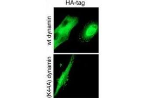 GTPase activity of Dynamin-2 is required for endocytosis of cell-surface tTG. (HA-Tag Antikörper)