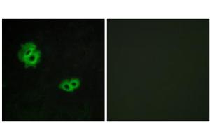 Immunofluorescence analysis of MCF-7 cells, using GPR171 antibody. (GPR171 Antikörper  (Internal Region))