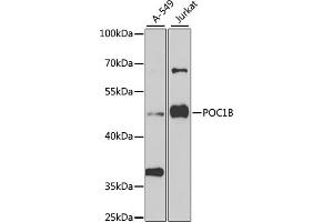 Western blot analysis of extracts of various cell lines, using POC1B antibody (ABIN6132854, ABIN6145868, ABIN6145869 and ABIN6223533) at 1:1000 dilution. (POC1B Antikörper  (AA 299-478))