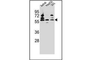 Western blot analysis of PDP1 Antibody (Center) in Jurkat,HepG2,293 cell line lysates (35ug/lane). (PDP Antikörper  (Middle Region))
