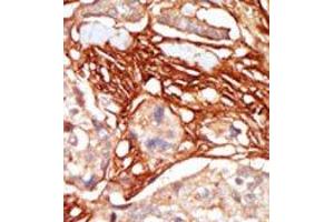 Image no. 1 for anti-V-Raf Murine Sarcoma 3611 Viral Oncogene Homolog (ARAF) (Middle Region) antibody (ABIN360127) (ARAF Antikörper  (Middle Region))