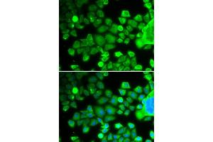Immunofluorescence analysis of MCF-7 cells using RPS10 antibody (ABIN6132945, ABIN6147192, ABIN6147194 and ABIN6221686). (RPS10 Antikörper  (AA 1-165))