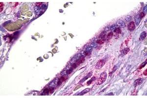 Anti-SMO antibody IHC staining of human placenta, cytotrophoblast. (SMO Antikörper)