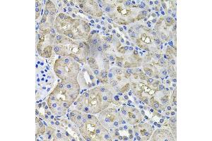 Immunohistochemistry of paraffin-embedded rat kidney using ACO1 antibody (ABIN5995389) at dilution of 1/100 (40x lens). (Aconitase 1 Antikörper)