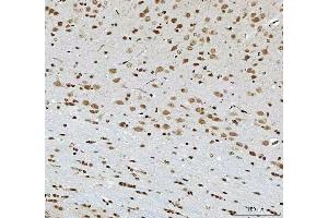 IHC analysis of THAP11 using anti-THAP11 antibody (ABIN7599230). (THAP11 Antikörper  (AA 1-294))