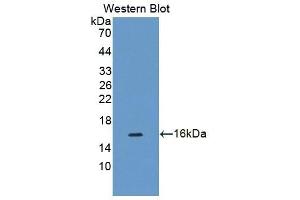 Detection of Recombinant CDK2AP1, Human using Polyclonal Antibody to Cyclin Dependent Kinase 2 Associated Protein 1 (CDK2AP1) (CDK2AP1 Antikörper  (AA 1-115))