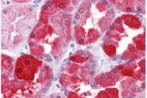 Human Kidney: Formalin-Fixed, Paraffin-Embedded (FFPE) (CRYM Antikörper  (AA 215-315))
