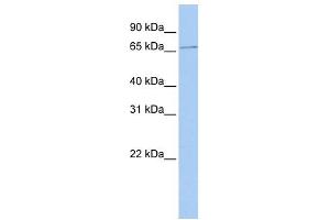 WB Suggested Anti-SCMH1 Antibody Titration: 0. (SCMH1 Antikörper  (Middle Region))
