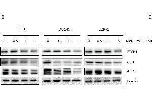 Link between metformin and Hedgehog signaling. (GLI2 Antikörper  (Internal Region))