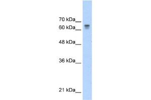 WB Suggested Anti-PAntibody Titration:  0. (PARP6 Antikörper  (C-Term))
