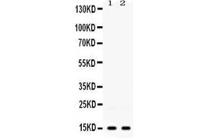 Western blot analysis of ISG15 expression in 22RV1 whole cell lysates ( Lane 1) and HELA whole cell lysates ( Lane 2). (ISG15 Antikörper  (AA 2-157))