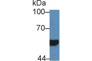 Detection of HNF1b in Human Serum using Polyclonal Antibody to Hepatocyte Nuclear Factor 1 Beta (HNF1b) (HNF1B Antikörper  (AA 159-300))