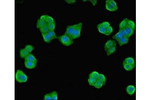 Immunofluorescent analysis of PC-3 cells using ABIN7162039 at dilution of 1:100 and Alexa Fluor 488-congugated AffiniPure Goat Anti-Rabbit IgG(H+L) (NME3 Antikörper  (AA 20-169))