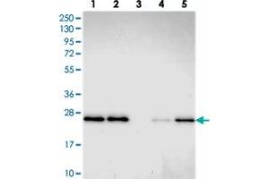 Western blot analysis of Lane 1: RT-4, Lane 2: U-251 MG, Lane 3: Human Plasma, Lane 4: Liver, Lane 5: Tonsil with GDF6 polyclonal antibody . (GDF6 Antikörper)
