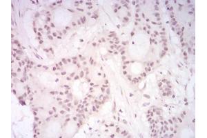 Immunohistochemical analysis of paraffin-embedded HeLa tissues using DDX39B mouse mAb with DAB staining. (DDX39B Antikörper  (AA 1-250))