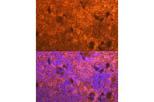 Immunofluorescence analysis of mouse spleen using CD3D Rabbit mAb (ABIN7266193) at dilution of 1:100 (40x lens). (CD3D Antikörper)