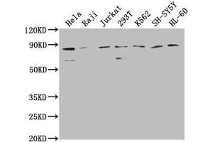 Western Blot Positive WB detected in: Hela whole cell lysate, Raji whole cell lysate, Jurkat whole cell lysate, 293T whole cell lysate, K562 whole cell lysate, SH-SY5Y whole cell lysate, HL-60 whole cell lysate All lanes: ZRANB1 antibody at 1:2000 Secondary Goat polyclonal to rabbit IgG at 1/50000 dilution Predicted band size: 81 kDa Observed band size: 81 kDa (ZRANB1 Antikörper  (AA 111-397))