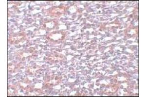 Immunohistochemistry of PIAS1 in rat kidney tissue with PIAS1 Antibody  at 5 μg/ml (PIAS1 Antikörper  (C-Term))