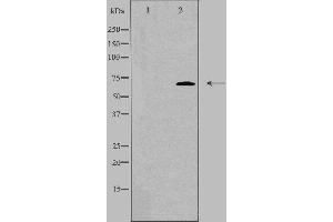Western blot analysis of extracts from HeLa cells, using DDX55 antibody. (DDX55 Antikörper  (Internal Region))