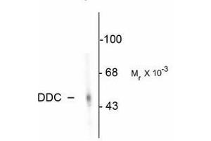 Image no. 2 for anti-Dopa Decarboxylase (Aromatic L-Amino Acid Decarboxylase) (DDC) antibody (ABIN220954) (DDC Antikörper)