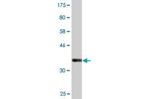 Western Blot detection against Immunogen (36. (Syntaxin 16 Antikörper  (AA 1-99))