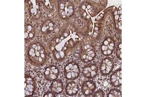 Immunohistochemical staining of human colon with FCHO1 polyclonal antibody  shows moderate cytoplasmic, nuclear and membranous positivity in glandular cells. (FCHO1 Antikörper)