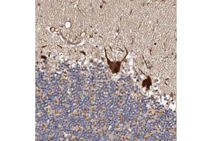 Immunohistochemical staining (Formalin-fixed paraffin-embedded sections) of human cerebellum with ADAMTS2 polyclonal antibody  shows strong positivity in Purkinje cells. (Adamts2 Antikörper)