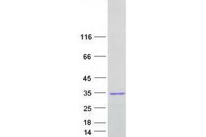 Western Blotting (WB) image for FGFR1 Oncogene Partner 2 (FGFR1OP2) protein (Myc-DYKDDDDK Tag) (ABIN2721119)