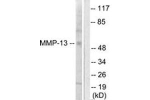 Western Blotting (WB) image for anti-Matrix Metallopeptidase 13 (Collagenase 3) (MMP13) (AA 10-59) antibody (ABIN2889227) (MMP13 Antikörper  (AA 10-59))