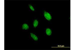 Immunofluorescence of purified MaxPab antibody to OVOL2 on HeLa cell. (OVOL2 Antikörper  (AA 1-275))