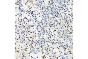 Immunohistochemistry of paraffin-embedded human appendicitis using SUMO4 Antibody (ABIN5971586) at dilution of 1/100 (40x lens).