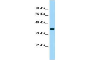 Host: Rabbit Target Name: SUCNR1 Sample Type: Fetal Heart lysates Antibody Dilution: 1. (SUCNR1 Antikörper  (Middle Region))
