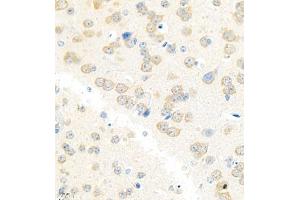 Immunohistochemistry analysis of paraffin embedded mouse brain using Erc2 (ABIN7073808) at dilution of 1: 3000