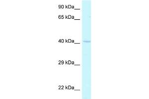 WB Suggested Anti-Hoxa2 Antibody Titration: 1. (HOXA2 Antikörper  (N-Term))