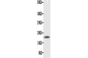 Western blot analysis of TNF alpha using anti- TNF alpha antibody . (TNF alpha Antikörper  (AA 80-235))