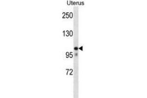 Western blot analysis in human normal Uterus cell line lysates (35ug/lane) using MOV10 Antibody (N-term). (MOV10 Antikörper  (N-Term))