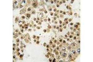 IHC analysis of FFPE human testis tissue stained with Parkin antibody