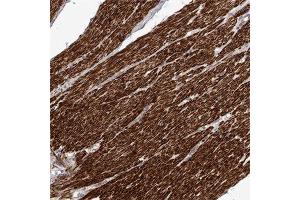 Immunohistochemical staining of human smooth muscle with FGFR4 polyclonal antibody  shows strong cytoplasmic positivity in smooth muscle cells at 1:50-1:200 dilution. (FGFR4 Antikörper)