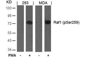 Western blot analysis of extracts from 293 and MDA cells untreated or treated with PMA using Raf1(Phospho-Ser259) Antibody. (RAF1 Antikörper  (pSer259))
