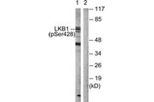 Western blot analysis of extracts from HeLa cells treated with PMA 125ng/ml 30', using LKB1 (Phospho-Ser428) Antibody. (LKB1 Antikörper  (pSer428))