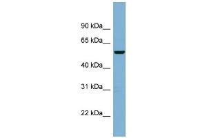 WB Suggested Anti-C2orf29 Antibody Titration: 0. (CNOT11 Antikörper  (Middle Region))