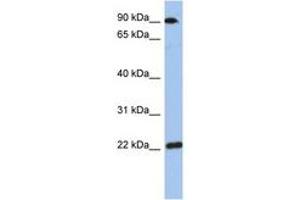 Image no. 1 for anti-Transmembrane Emp24-Like Trafficking Protein 10 (TMED10) (AA 143-192) antibody (ABIN6744308)