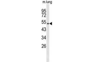 Western blot analysis of MUTYH (arrow) in mouse lung tissue lysates (35ug/lane) using MUTYH