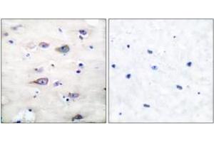 Immunohistochemistry (IHC) image for anti-Glutamate Receptor, Ionotropic, AMPA 2 (GRIA2) (pSer880) antibody (ABIN2888427) (GRIA2 Antikörper  (pSer880))