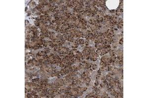 Immunohistochemical staining of human pancreas with CAMSAP1 polyclonal antibody  shows strong cytoplasmic positivity in exocrine glandular cells at 1:200-1:500 dilution. (CAMSAP1 Antikörper)