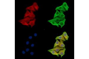 ABIN7097165 and ABIN7101233 staining Hela cells by IF/ICC.